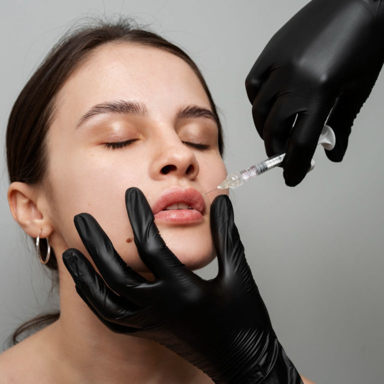 Filler Behandlung-Suna-Kaya