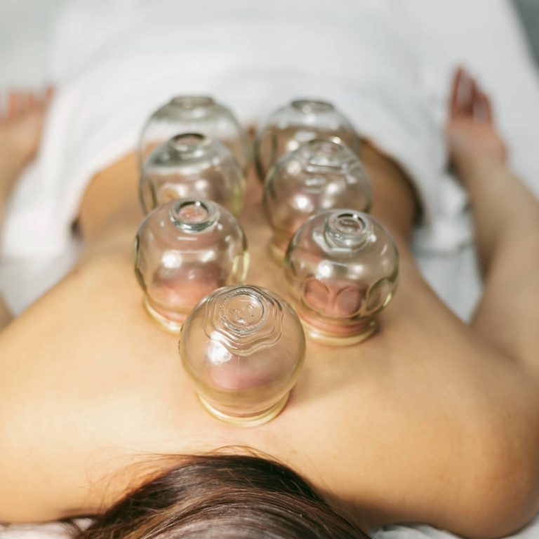 Suna Kaya Hijama Schroepftherapie